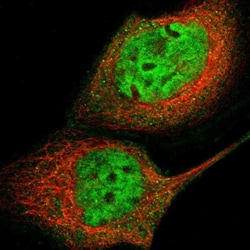 GCR2 Antibody, Novus Biologicals:Antibodies:Primary Antibodies